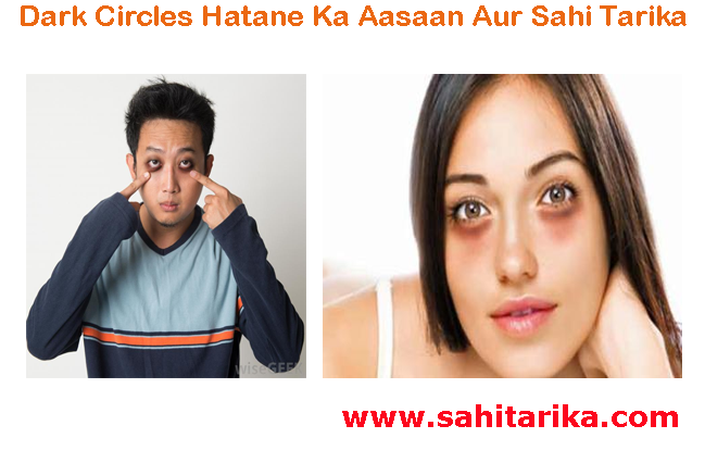 Photo of Dark Circles Hatane Ka Aasaan Aur Sahi Tarika